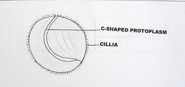 CHILODINELLA