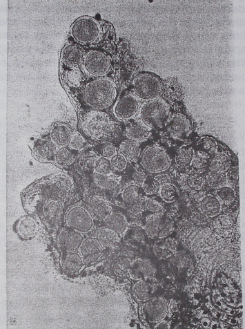 Lymphocystis