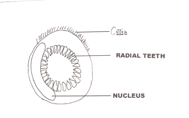 Trichodina
